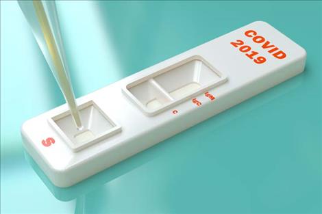 Antibody tests available, not completely reliable
